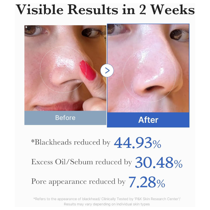 Medicube Zero Pore Pads 2.0, Dual-Textured Facial Toner Pads for Exfoliation and Pore Care with 4.5% AHA Lactic Acid & 0.45% BHA Salicylic Acid, Ideal for All Skin Types, Korean Skin Care